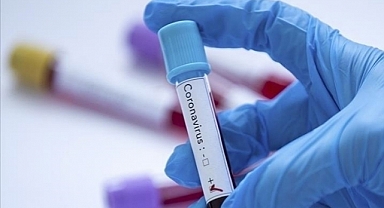 KOVİD-19 Vaka Artışı Sürüyor